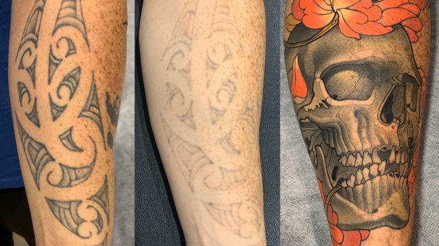 Tattoo Fade Cream – How Effective Is They?