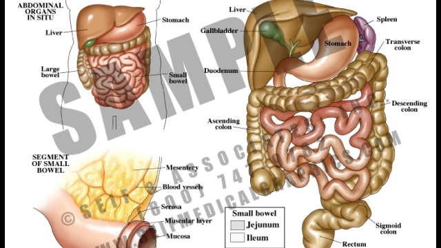 Slimming Down: The Ultimate Guide to Liposuction